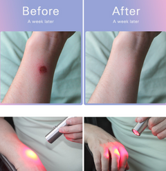 Portable Infrared Red Light Therapy Torch